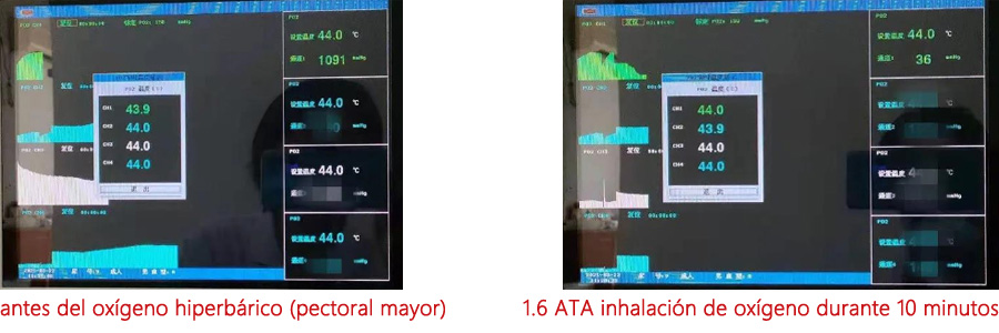 Transcutaneous pressure of Oximetry (tcpO2）-2西语